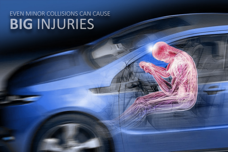 When to Call a Personal Injury Attorney